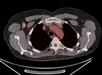 Figure 30B