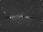 Dual energy CT